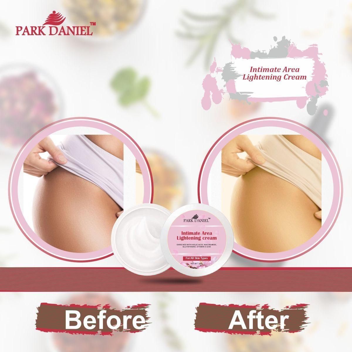 Intimate Area Lightening Cream (100g)